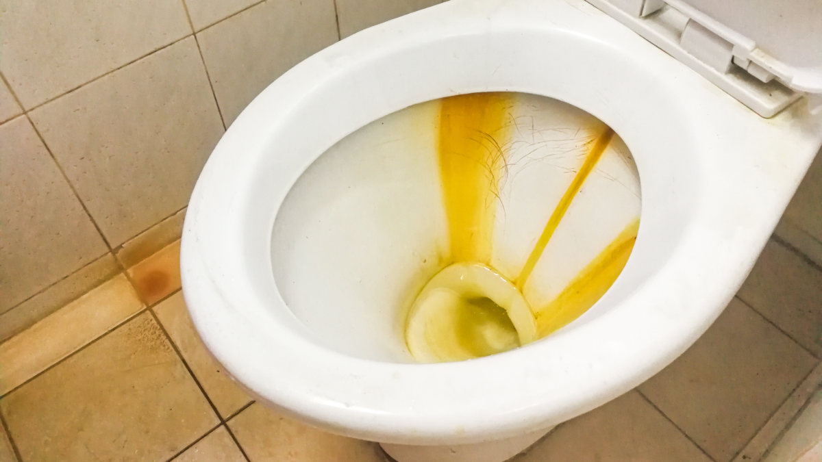 A very stain toilet in need to deep cleaning